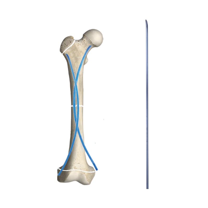 Elastic Intramedullary Pin II